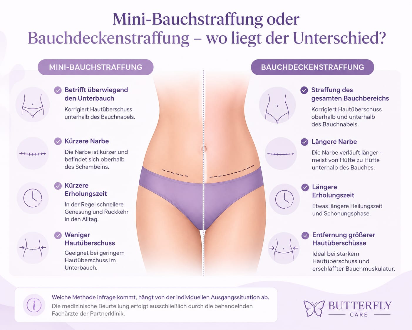 Bauchdeckenstraffung – Mini vs. vollständig