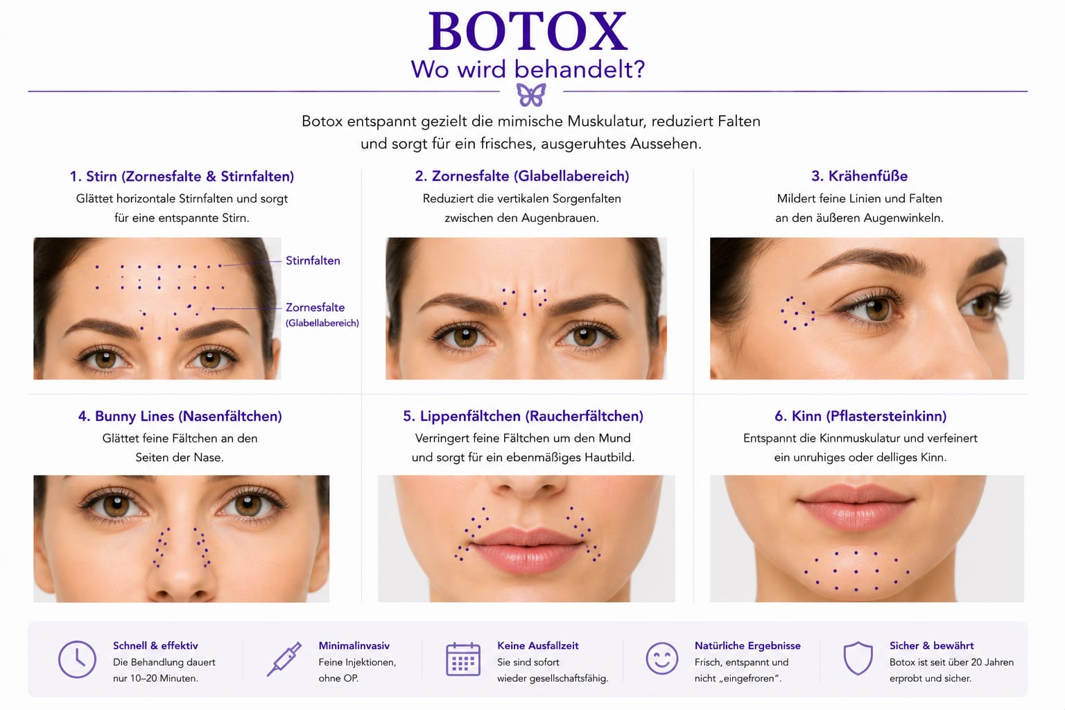 Botox / Botulinumtoxin