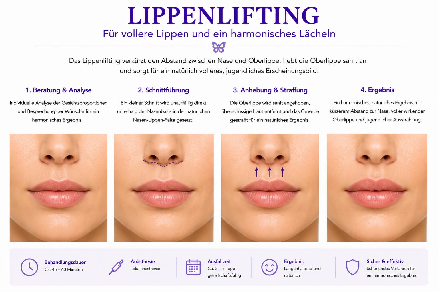 Lippenlifting