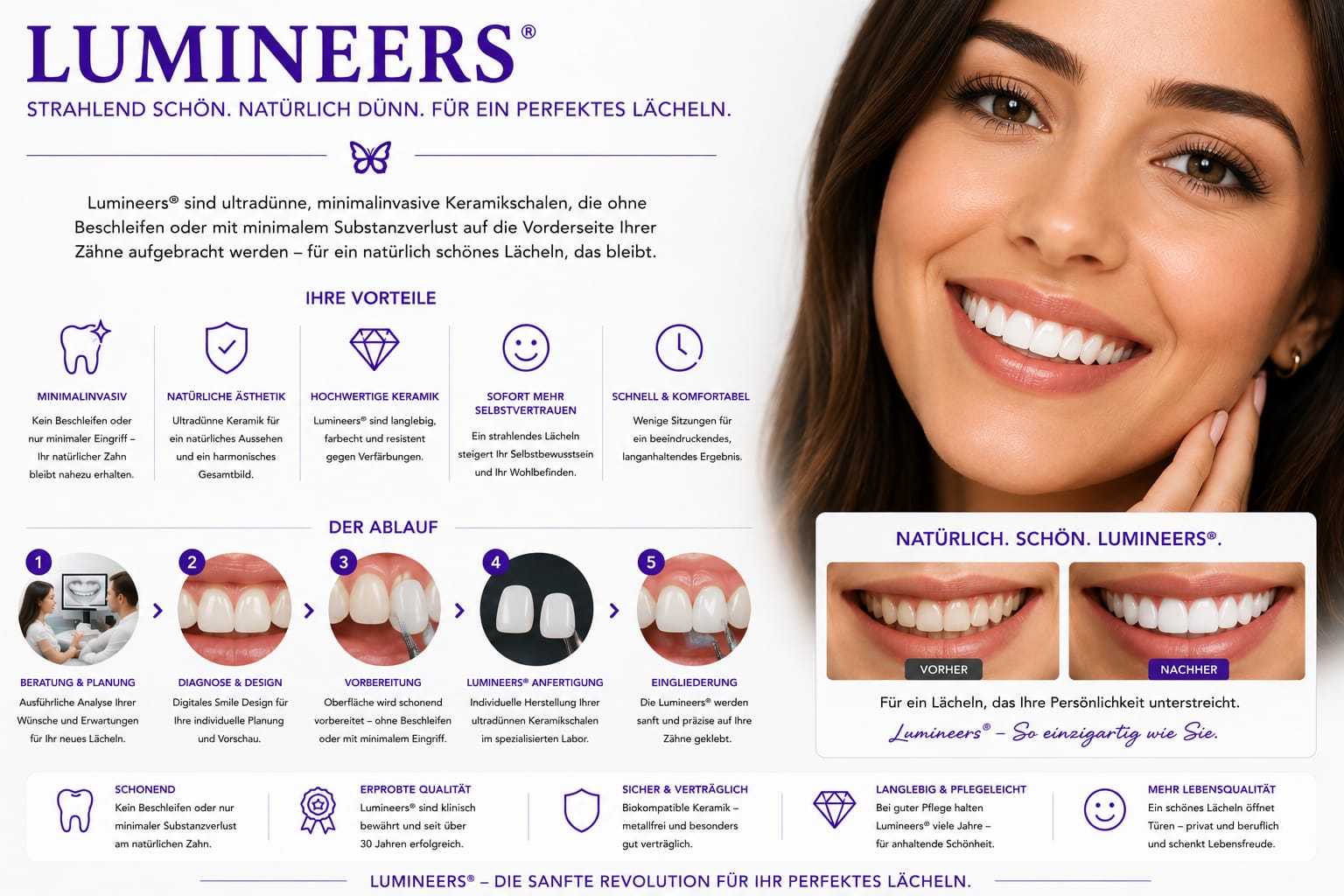 Lumineers / Non-Prep-Veneers