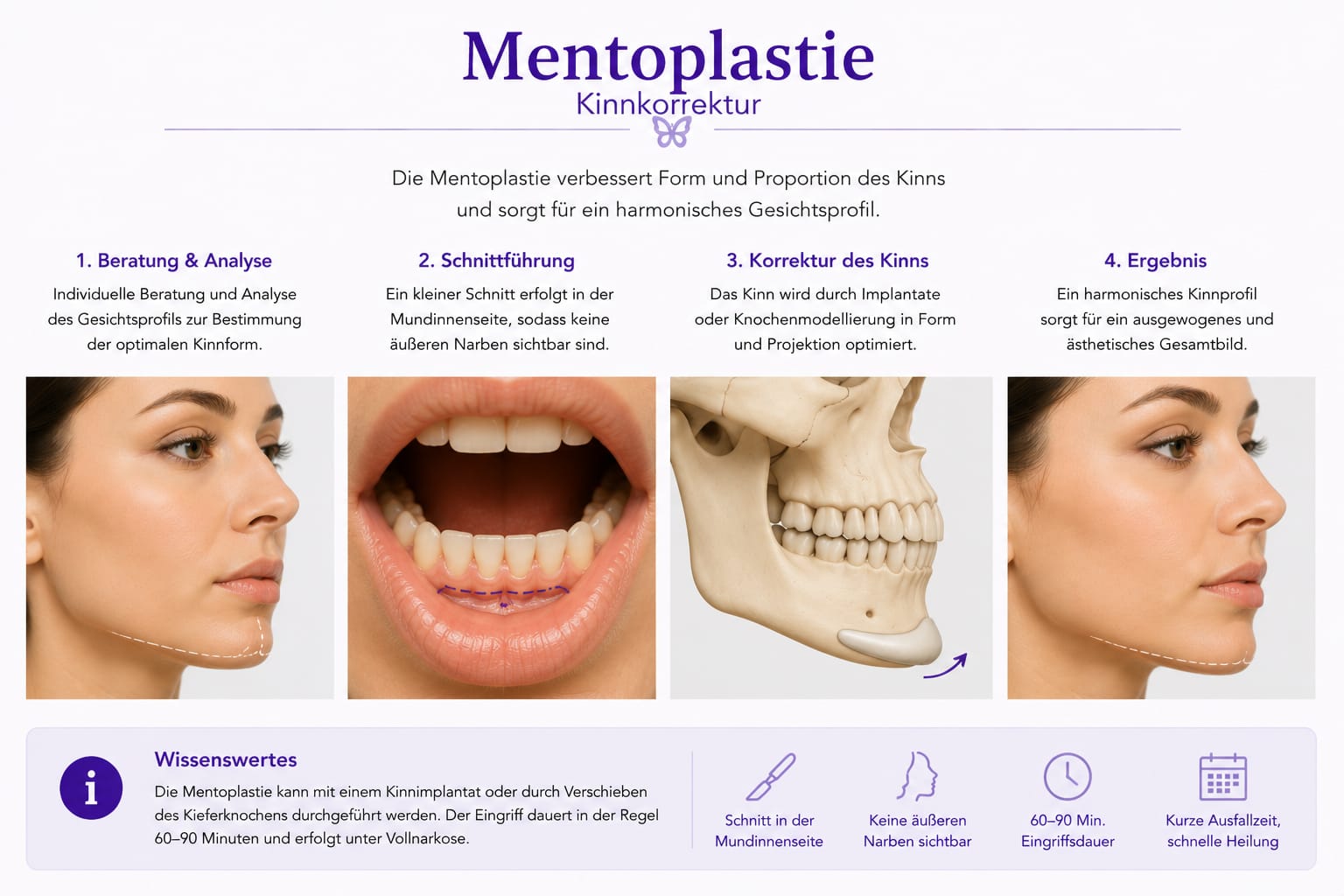 Mentoplastie – Kinnkorrektur