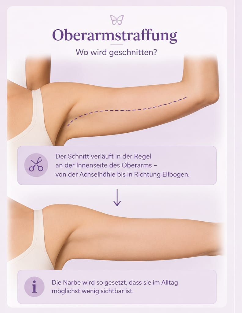 Oberarmstraffung