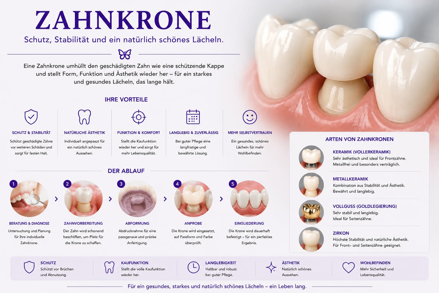 Zahnkrone